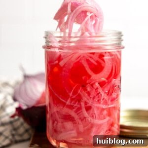 My Secret Weapon Pickled Red Onions 10 A jar filled with tangy and sweet pickled red onion being served up with a fork.